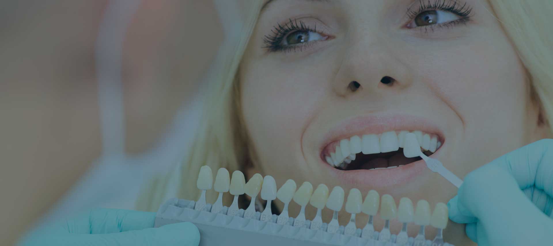 Mulher loira aplicando prótese dentária
